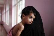 یارانه کودکان دارای سوءتغذیه فردا واریز می‌شود
